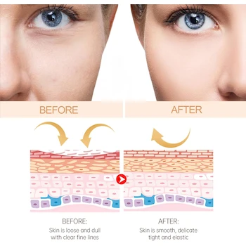 Imagen 5 de Bálsamo antiarrugas Herbaluxy, Bálsamo multiarrugas Herbaluxy, Bálsamo hidratante antiarrugas Herbaluxy, Bálsamo multiarrugas en barra, Bálsamo hidratante antiarrugas (3pcs)